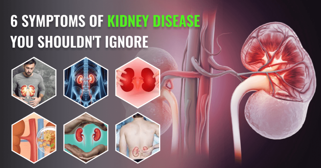 kidney diseases treatment