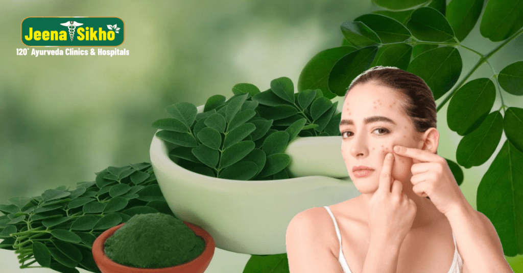 5 Benefits of Moringa Leaf Powder for Acne Prevention and Detoxifying Skin