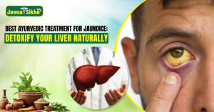 Ayurvedic-treatment-for-jaundice