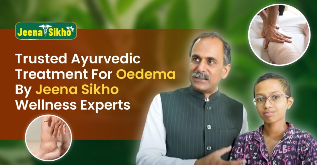 Ayurvedic-Treatment-for-Oedema