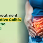 Natural Treatment for Ulcerative Colitis