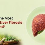 hat-Is-the-Most-Effective-Liver-Fibrosis-Treatment