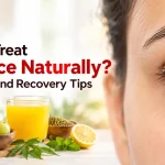 How-to-Treat-Jaundice-Naturally-Diet-Care-and-Recovery-Tips